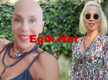 Billur Kalkavan’ın sağlık durumu! ‘Herkes soruyor, en iyisi buradan anlatmak’