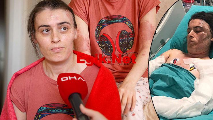 Eski elti dehşeti: 17 kez bıçaklayıp, üzerine kaynar su döktü