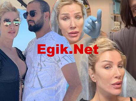 Haberler: Çenesine kontür yaptıran Seda Sayan’ın son hali!