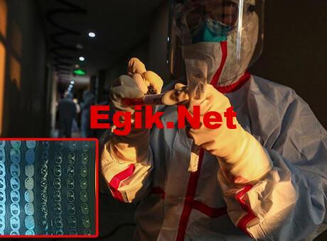 SON DAKİKA: Pandora’nın kutusu açıldı! Şifreli mesaj…