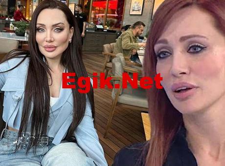 Umut Akyürek alın daraltma estetiği yaptırdı!