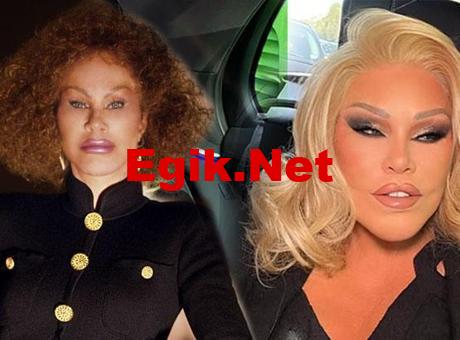 ‘Kedi Kadın’ hiç estetik ameliyatı olmamış!