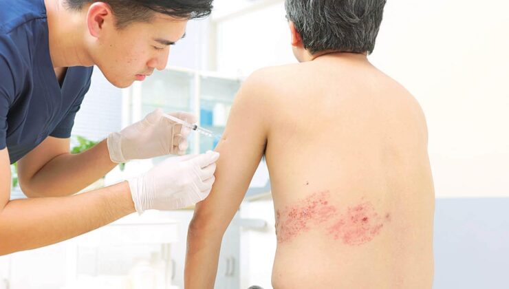 Zona aşısı demansa karşı