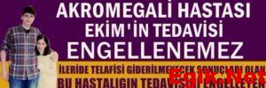 Akromegali Hastası Ekim Polat’ın Tedavi Hakkı Engelleniyor