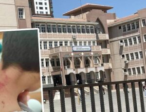 Şanlıurfa’da 10 yaşındaki öğrencisini döven öğretmen tutuklandı