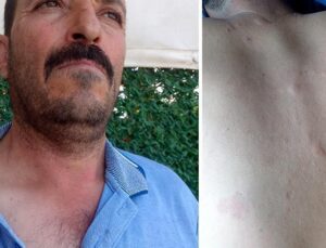 Duyduğu seslere giden çiftçi hayatının şokunu yaşadı! Ayı saldırısından kurtuldum derken dehşeti yaşadı