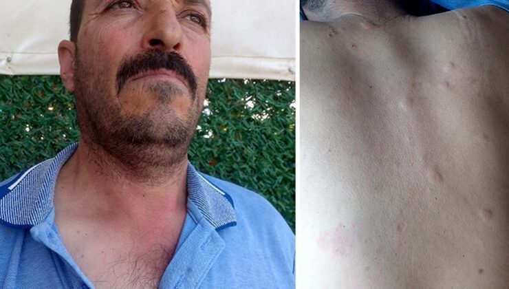 Duyduğu seslere giden çiftçi hayatının şokunu yaşadı! Ayı saldırısından kurtuldum derken dehşeti yaşadı