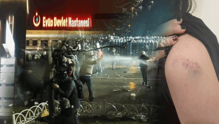 Devlet hastanesinden kırık burna ‘sağlam’ raporu!