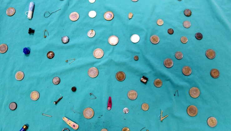 Para, toka, çivi, çatal iğne, küpe, yüzük, karabina, pil, oyuncak: Hepsi mideden çıktı!