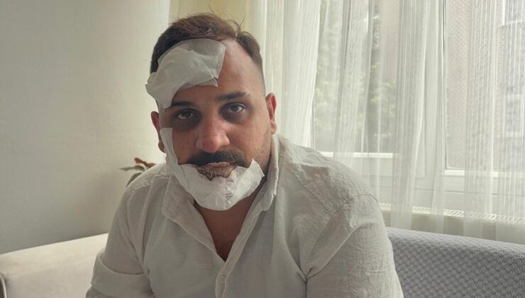 Eski sözlüye, polislerden öldüresiye dayak: ‘Sülaleni öldürürüz’