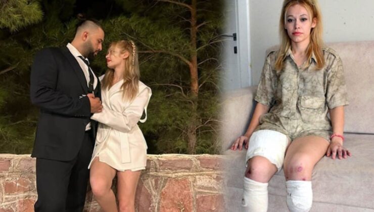 Evlilik yıl dönümünde bacaklarını kaybetti