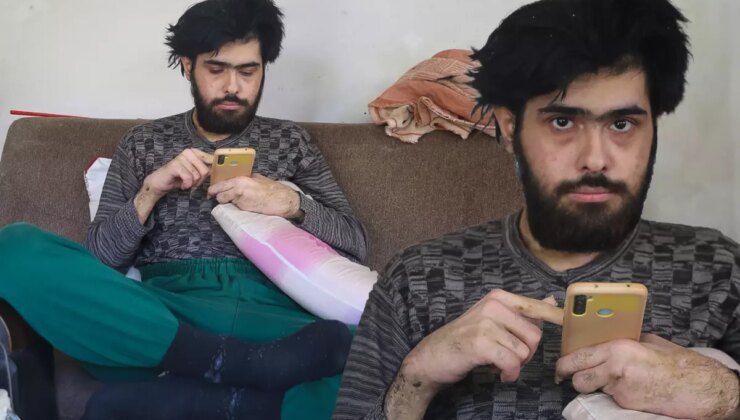 3 yıldır tırnaklarını kesmeyen ve duş almayan gencin eski hali ortaya çıktı