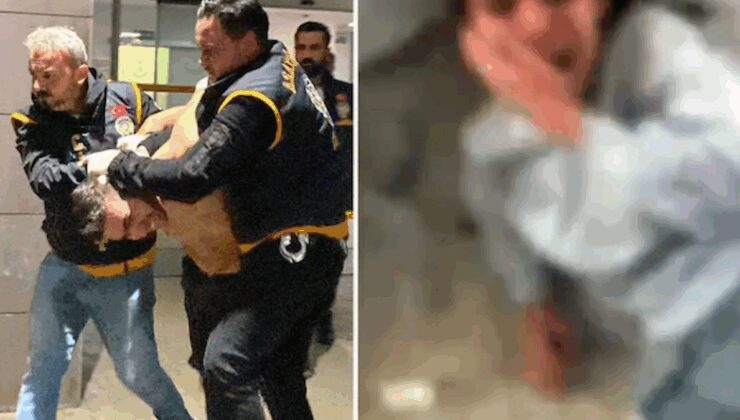 Kız kardeşine kaynar suyla eziyet eden ağabeyin ‘sebebi’ ortaya çıktı!