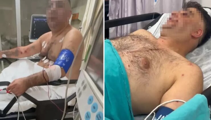 Bayrampaşa’da pompalı tüfekle çevreye ateş eden şahıs, 1’i polis 4 kişiyi yaraladı