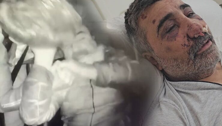 Taksiciyi öldüresiye dövdü: İngiliz boksörün mahkemedeki ifadesi ortaya çıktı