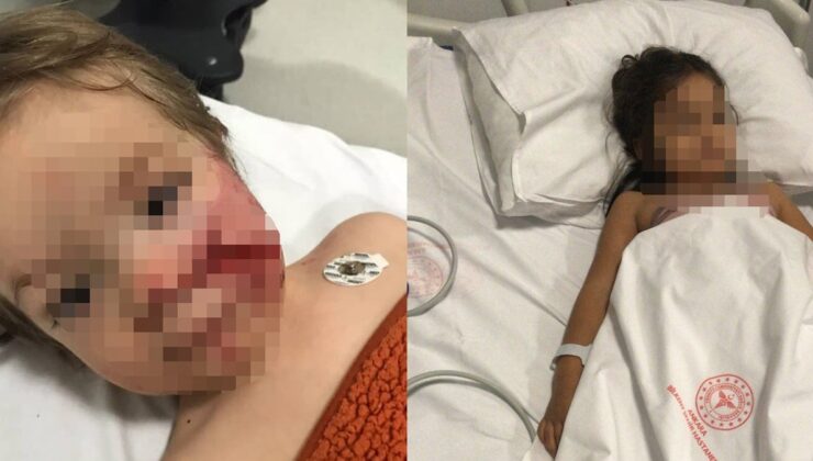 Bakan Yerlikaya duyurdu: Pitbull’un sahibi tutuklandı