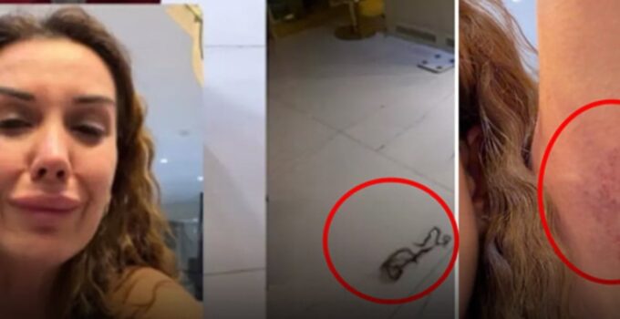 Dilan Polat en yakınından tekme tokat dayak yedi