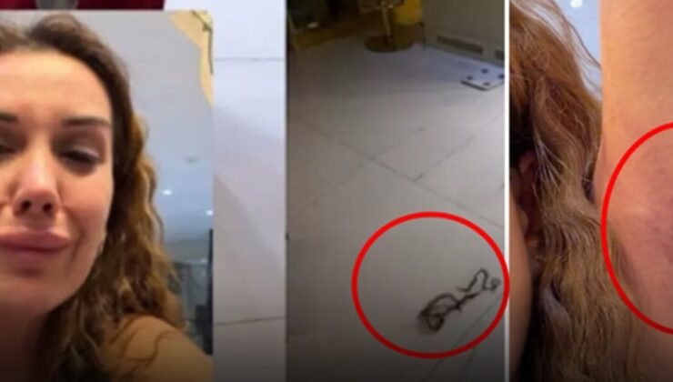 Dilan Polat en yakınından tekme tokat dayak yedi