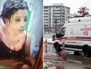 Bunun adı saf kötülük! Eşini koli bandıyla bağlayıp kezzapla yaktı