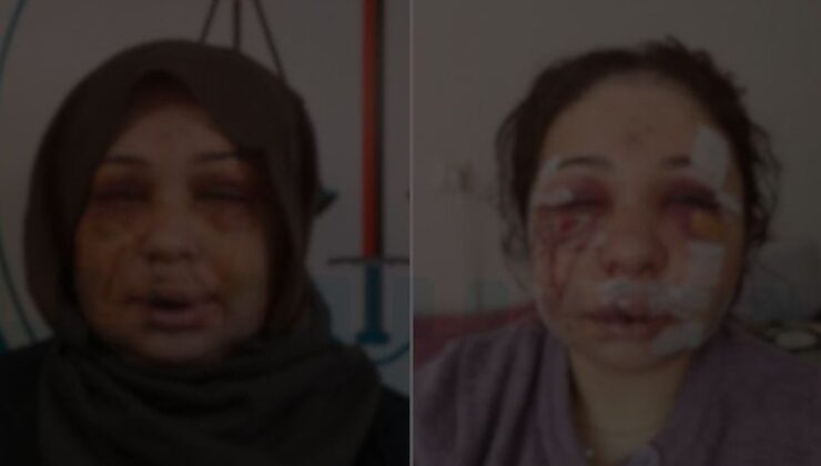 Eşini hastanelik eden polis, ifade verip serbest kaldı