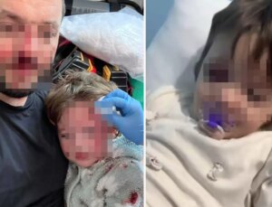 14 aylık İkra bebeğin yaralandığı olayda iki taraf da birbirini suçladı