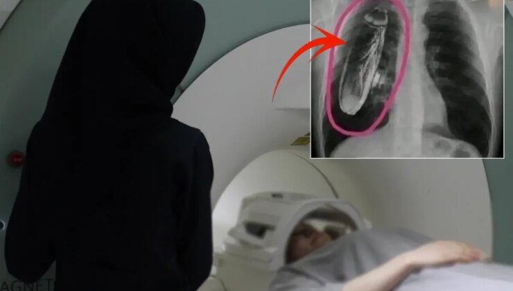 Hastaya “Göğsünde canlı böcek var” dendi, gerçek çok başka çıktı