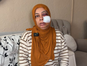 İskenderun’da elektrikli bisikleti ile kapağı kırık rögara düştü! ‘Ölümden döndüm’