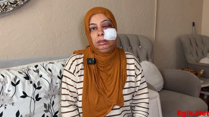 İskenderun’da elektrikli bisikleti ile kapağı kırık rögara düştü! ‘Ölümden döndüm’