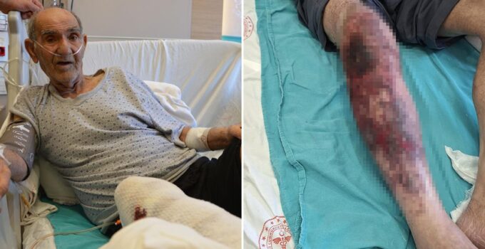 Herkesin başına gelebilir! Tıkalı lavaboyu açmak isterken yandı