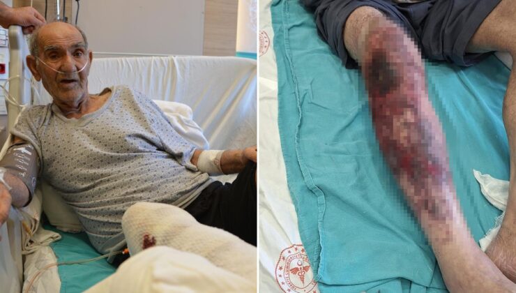 Herkesin başına gelebilir! Tıkalı lavaboyu açmak isterken yandı