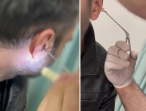 Kulağına gizlediği uyuşturucuyla yakalandı