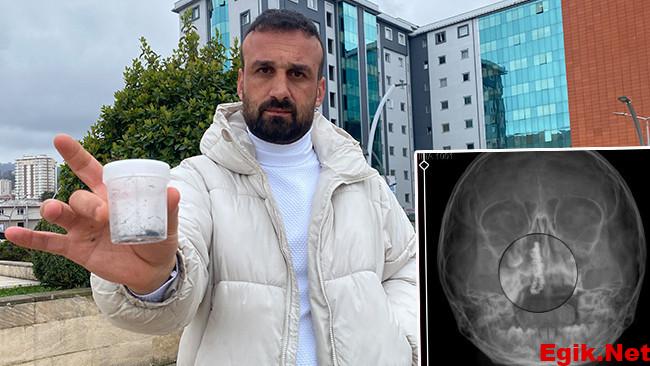 Şiddetli kanama ve akıntı şikayetiyle gitti: 5 yaşındaki Polen’in 2 yıl boyunca burnundaymış! ”Bu nasıl gözden kaçabilir?’