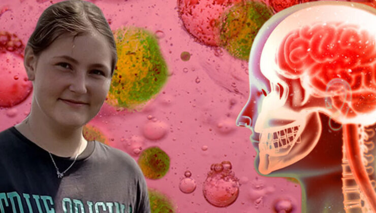 Panik dalgası büyüyor: 14 yaşındaki Çağla’yı hayattan kopardı… Türkiye’de vakalar artıyor mu? Bu ‘hayati işaretleri’ mutlaka öğrenin