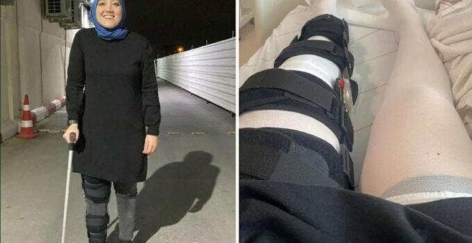 Doktordan inanılmaz skandal! Sağ dizi yerine sol diz ameliyat edildi: Uyanınca dünya başına yıkıldı